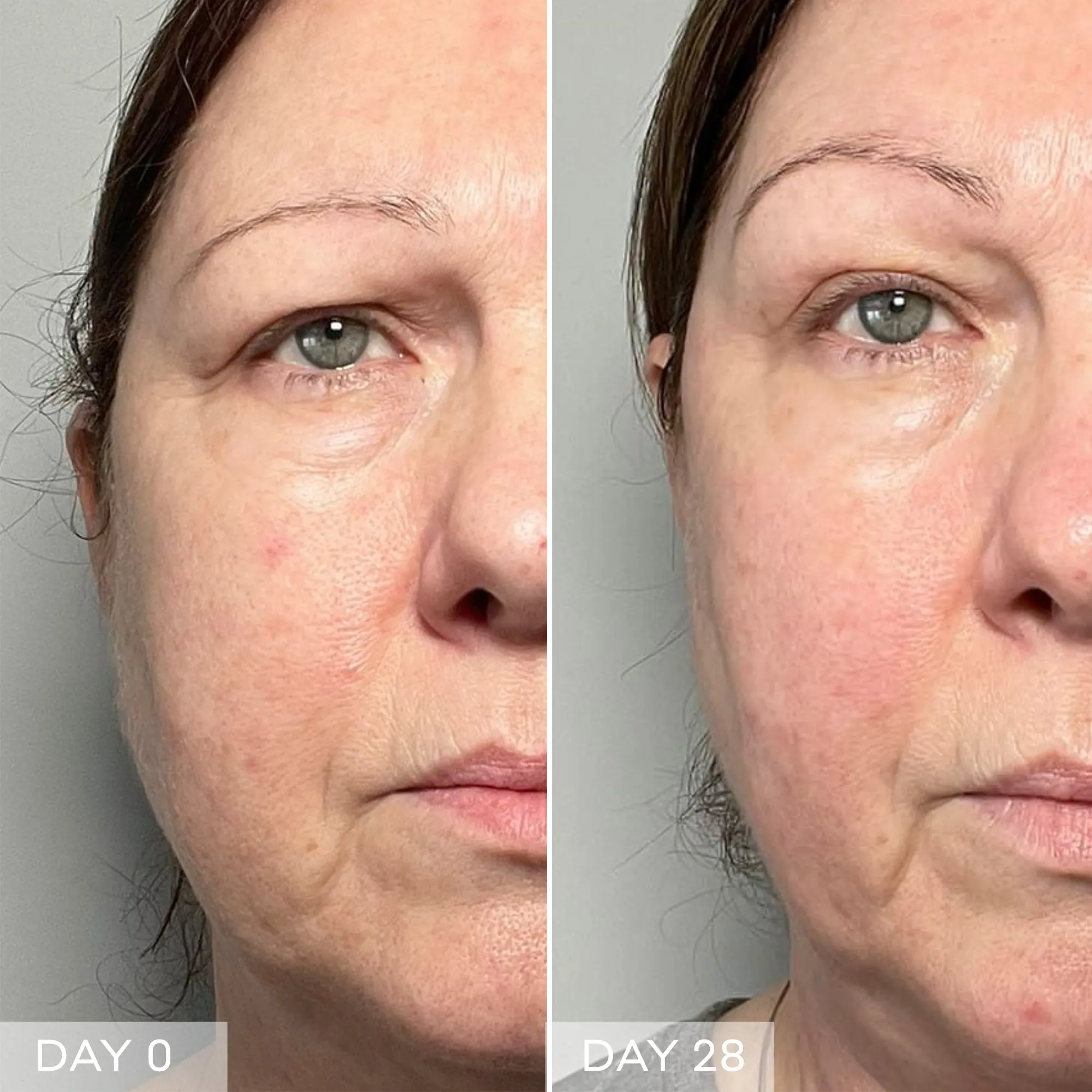 Face Rocket® Firm   Tone Collection